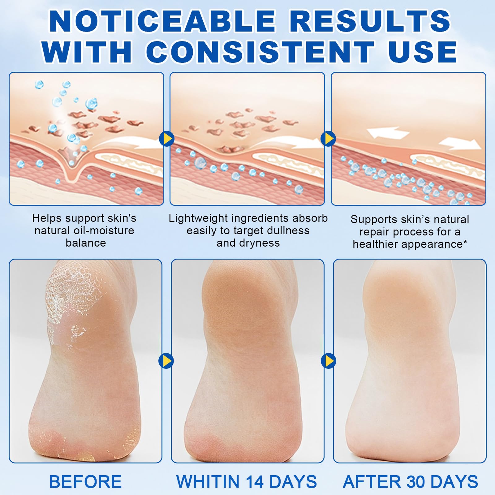 QJCWXIAOX callus remover softener targets dry areas on feet