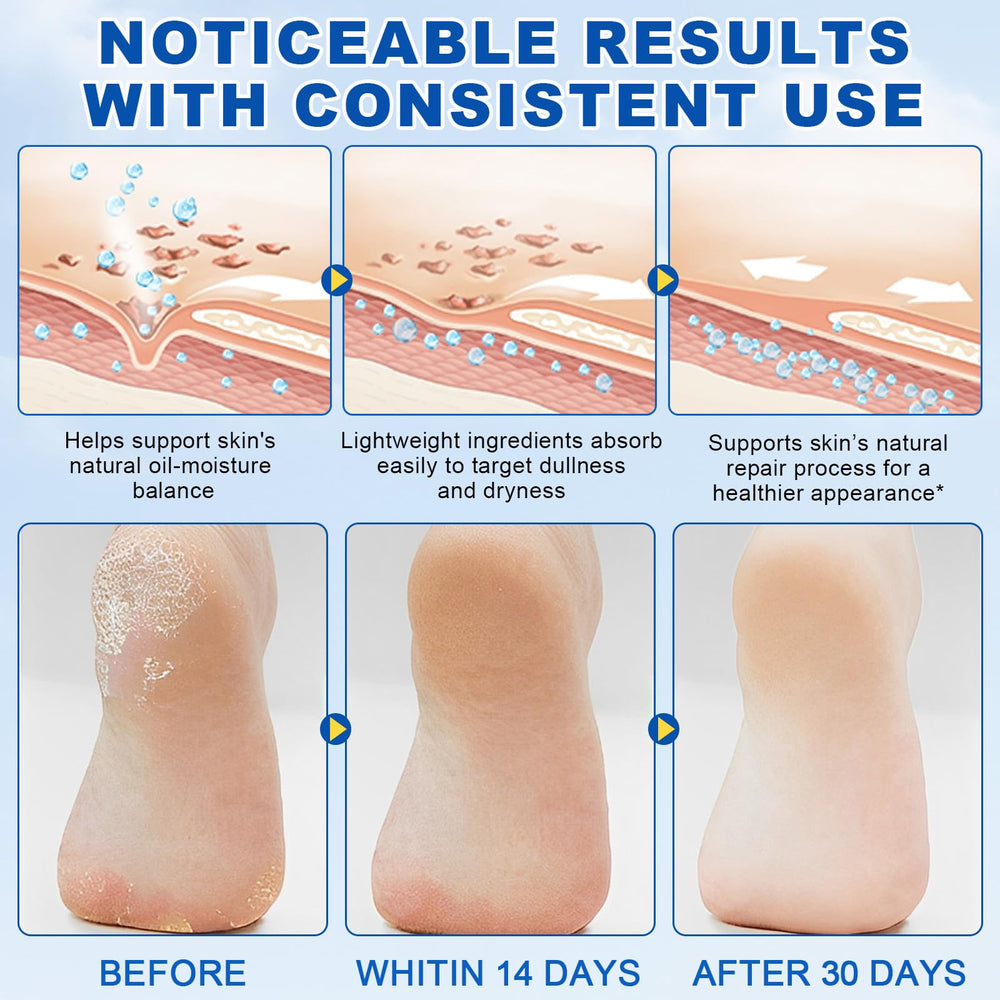 QJCWXIAOX callus remover softener targets dry areas on feet