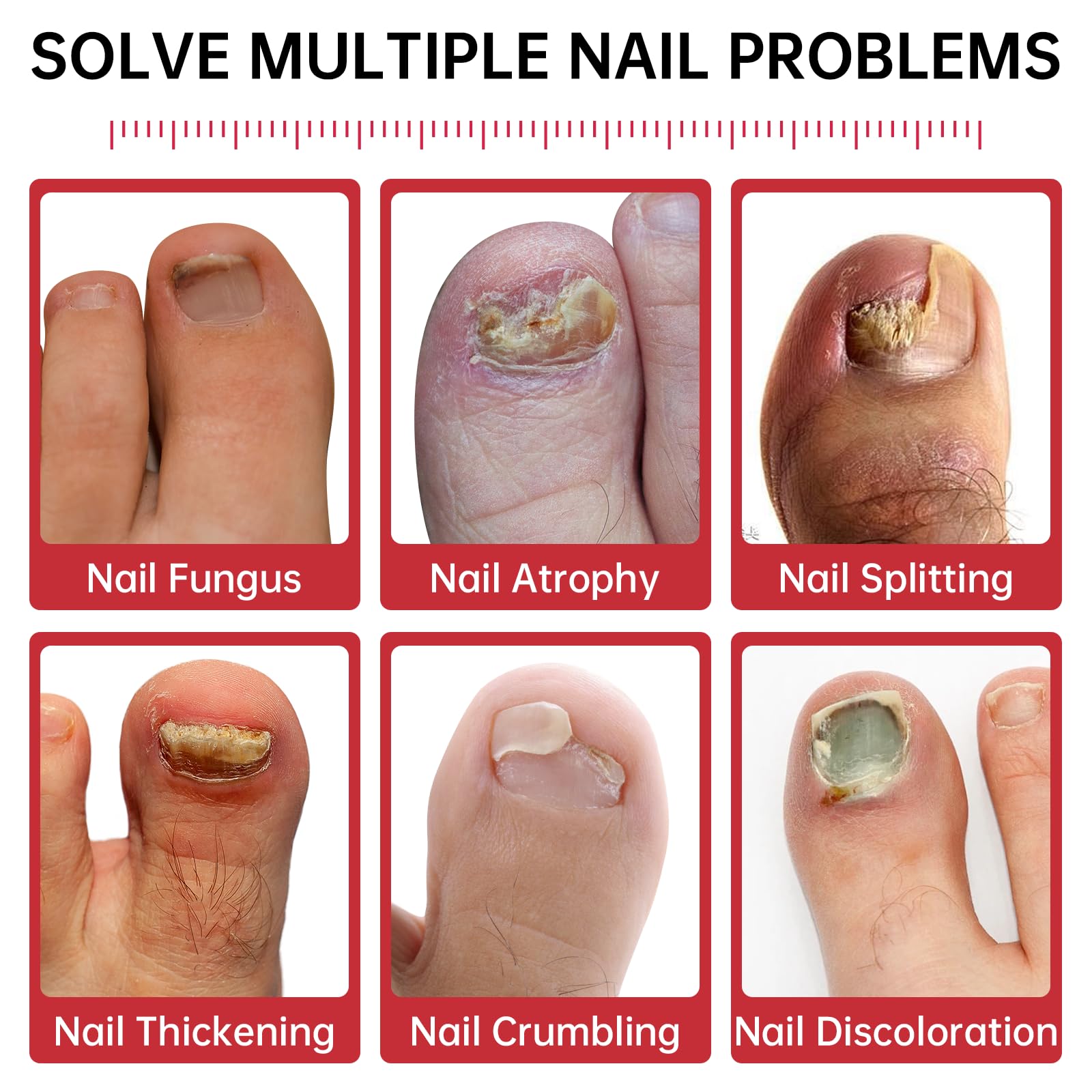 QQE Nail Fungus Treatment bottle highlighting 1% Tolnaftate for targeted action.