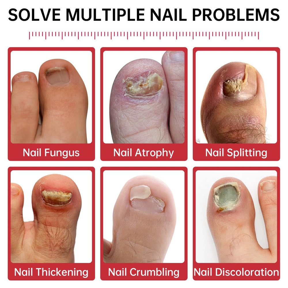 QQE Nail Fungus Treatment bottle highlighting 1% Tolnaftate for targeted action.