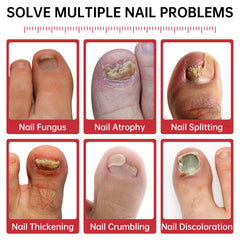 QQE Nail Fungus Treatment bottle highlighting 1% Tolnaftate for targeted action.
