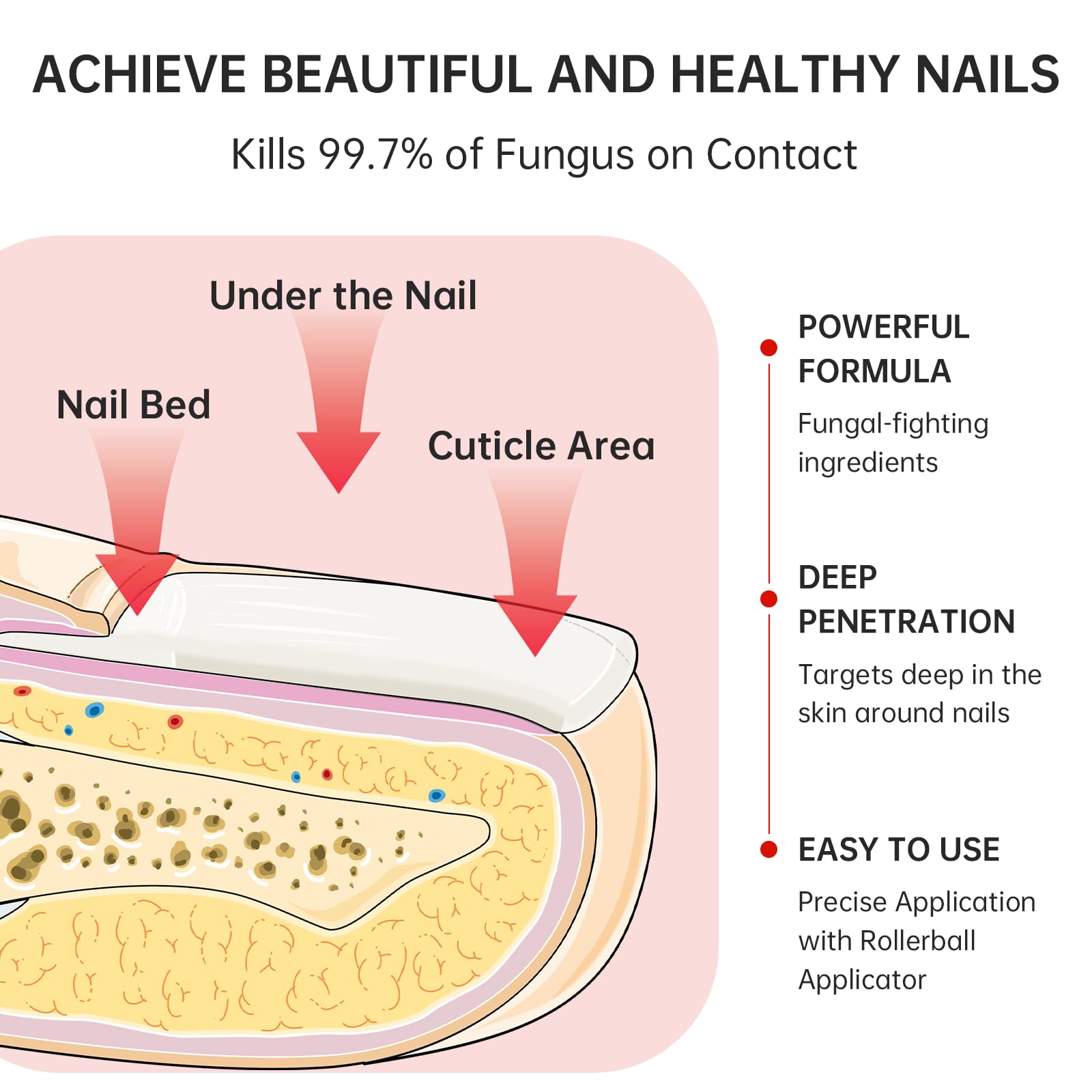 QQE Nail Fungus Treatment close-up shows nail discoloration for progress tracking.
