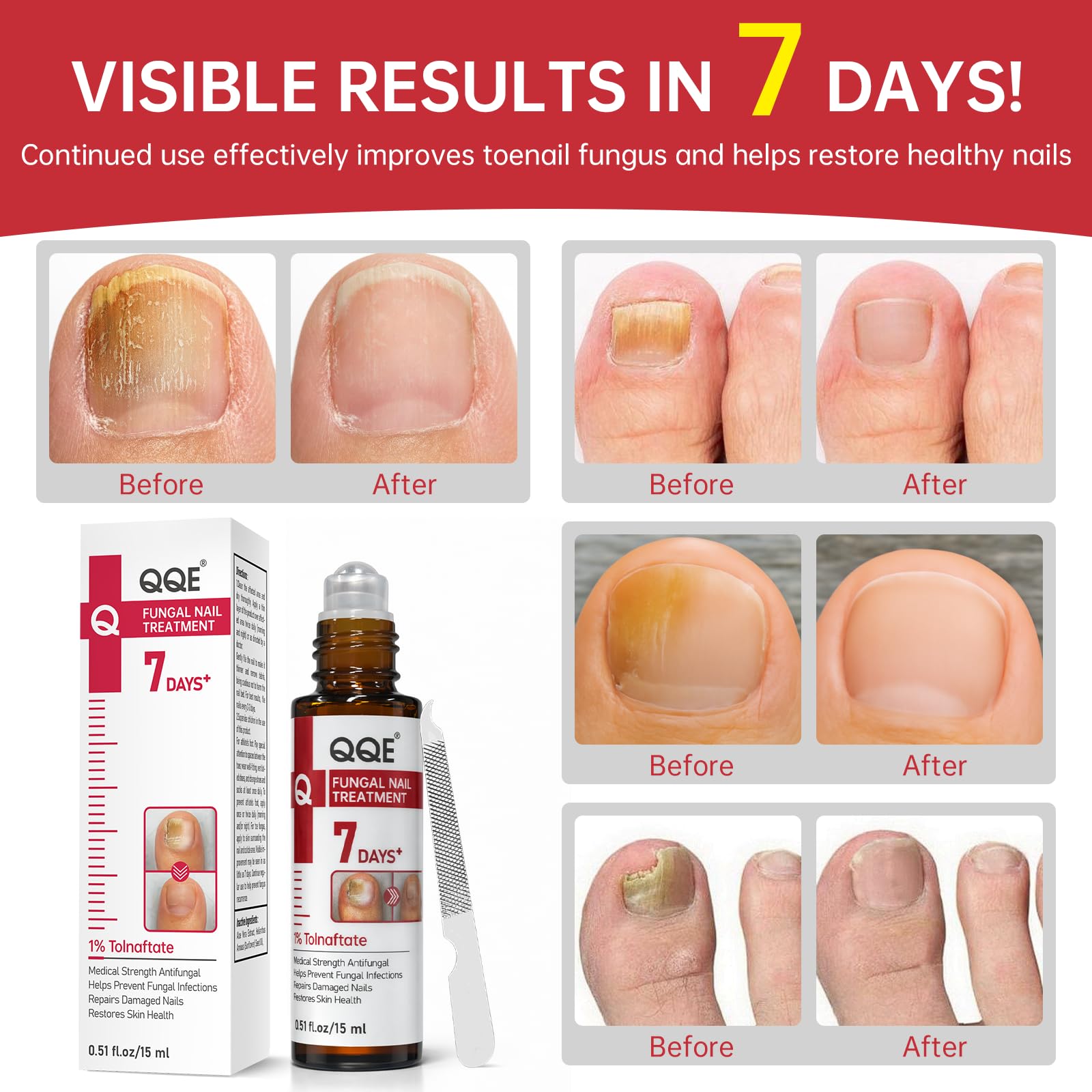 QQE applying to a toenail during routine care.