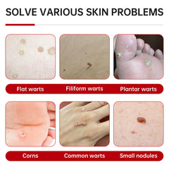 QQE wart remover liquid applied on wart for controlled treatment.