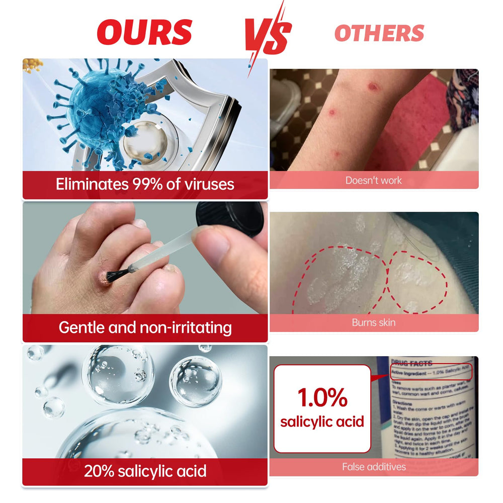QQE wart remover liquid supports hands-and-feet wart care.