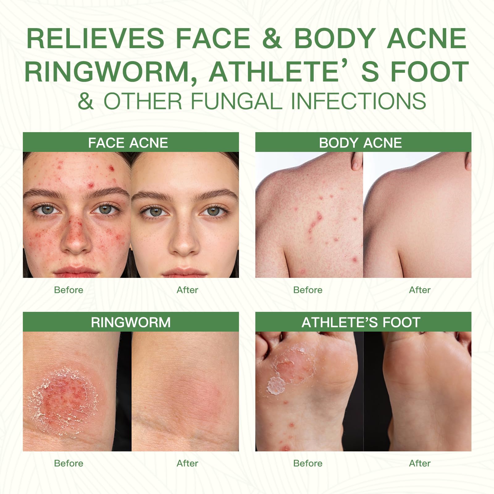 QualiLife Tea Tree Oil drops emphasize natural ingredients for balanced skin.