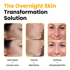APPLICATION shot of QUIA wrap demonstrates easy night-time wear