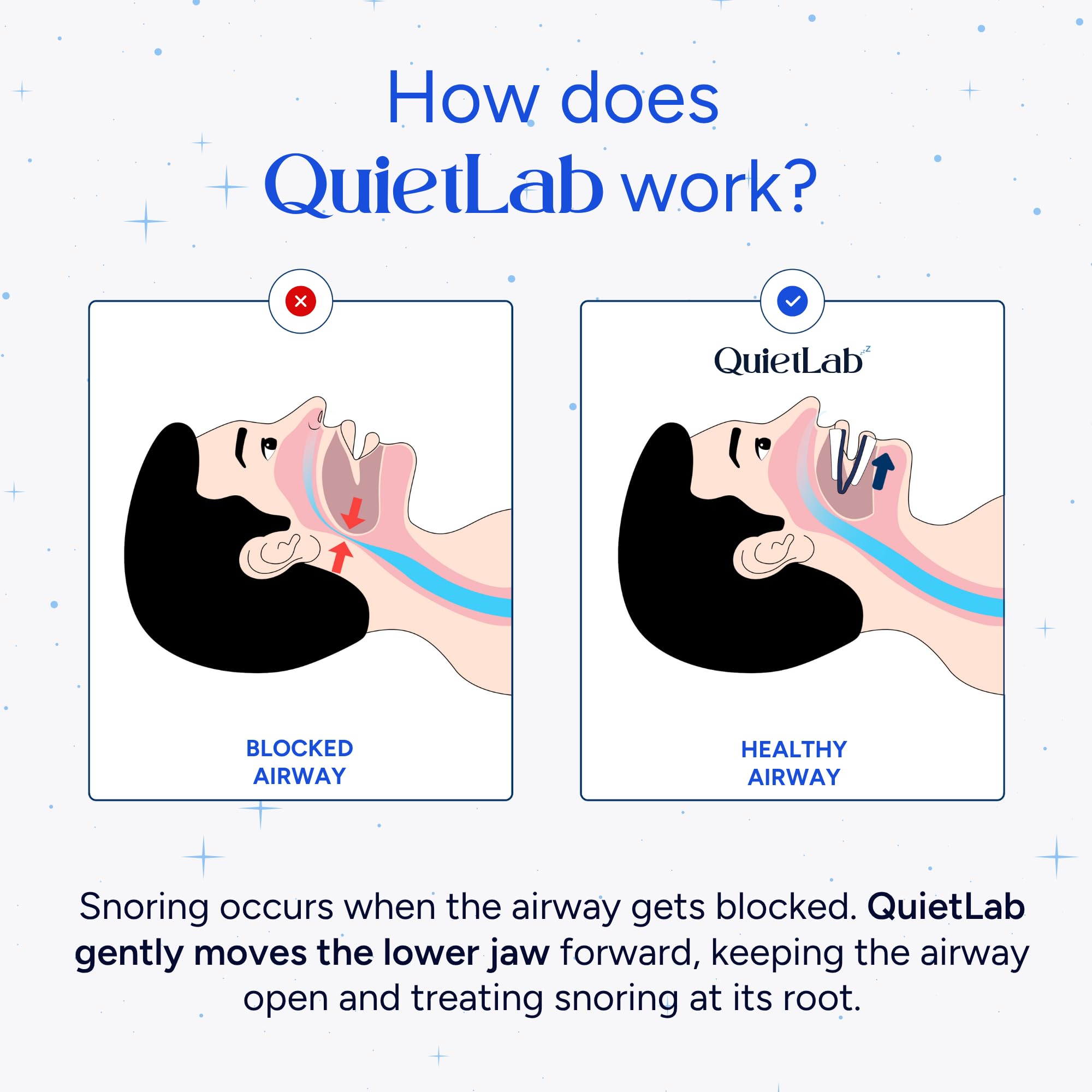 QuietLab Pro ultra-thin material visible for a discreet nighttime option.