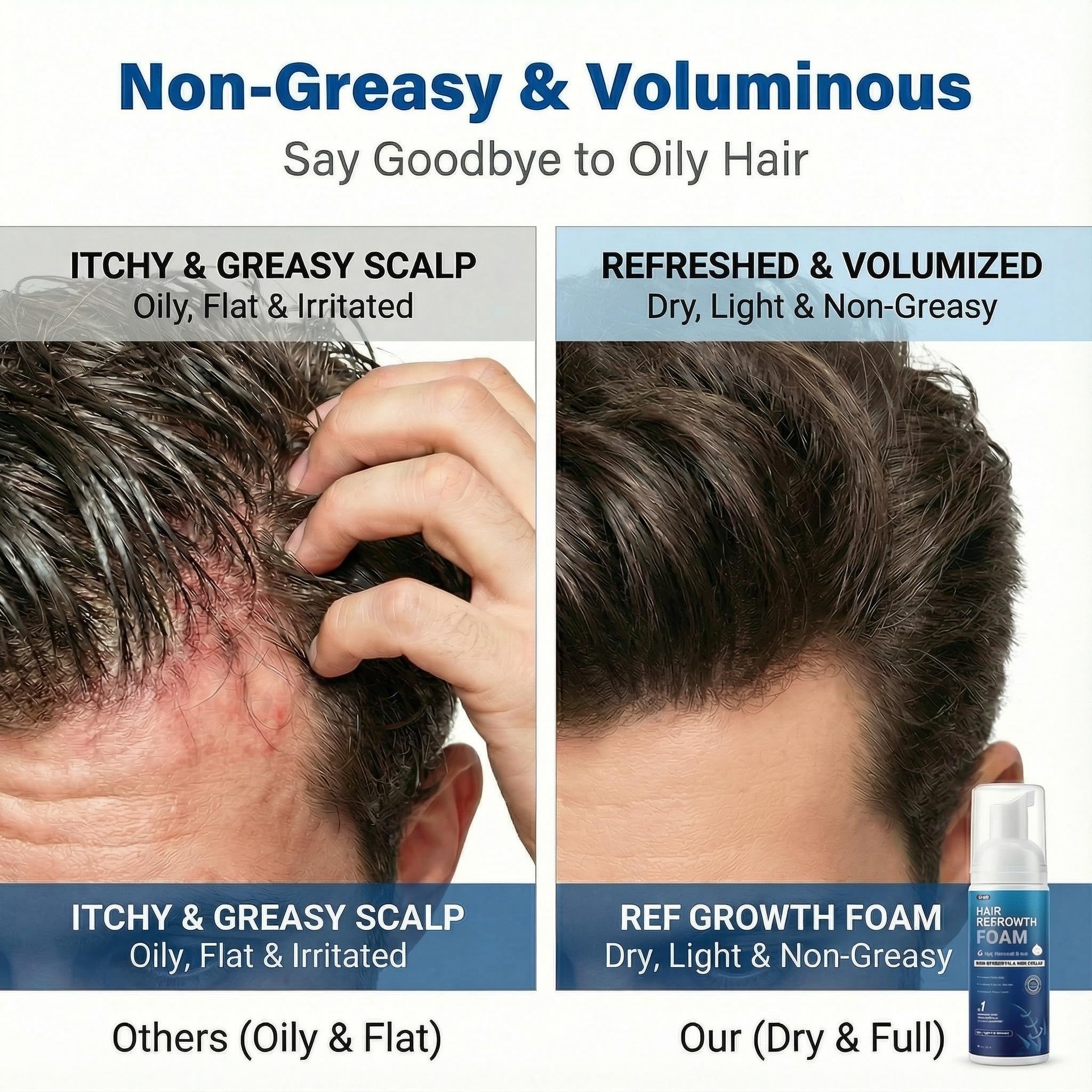 Quilom Minoxidil Foam pump ensures precise dosing