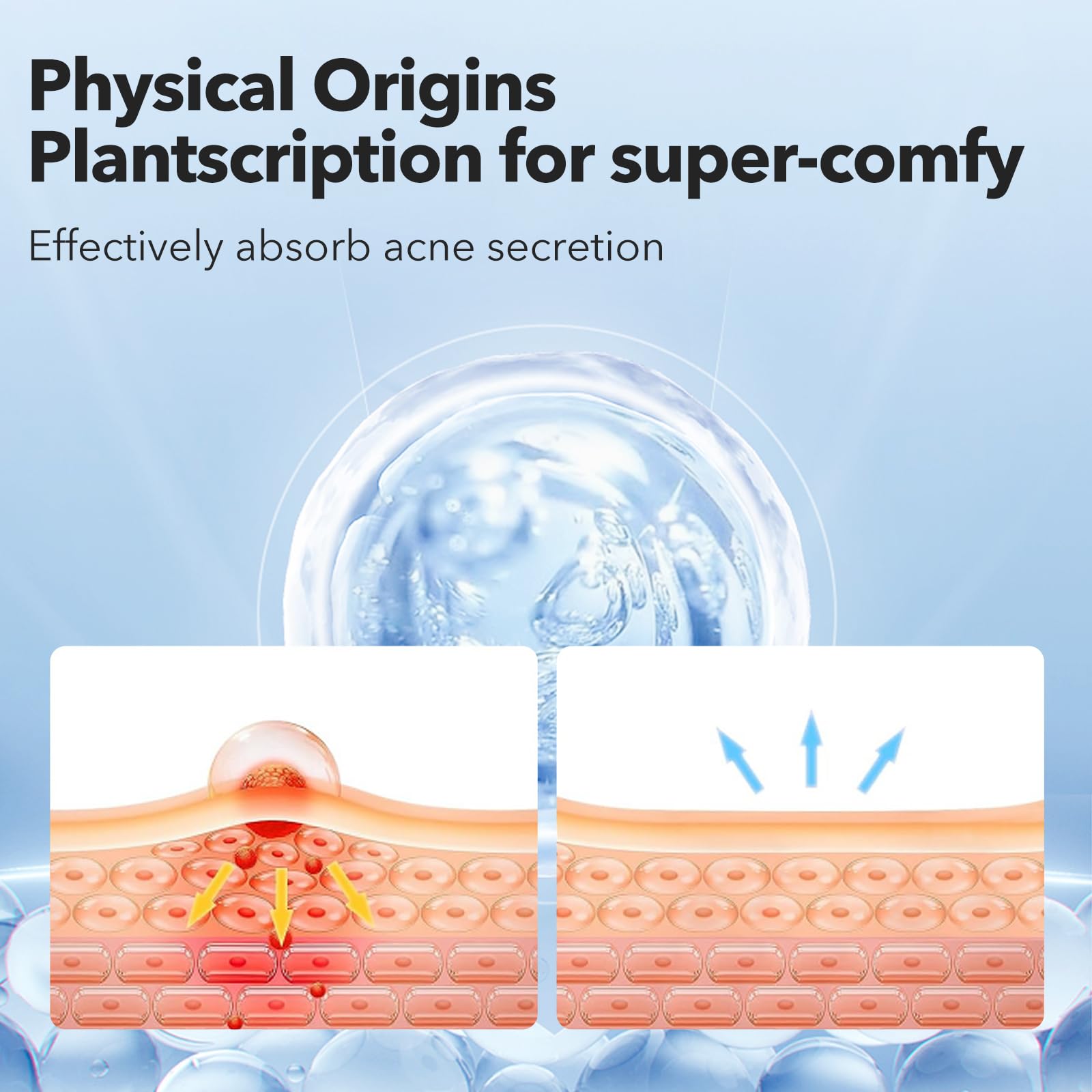QUSTERE pimple patches showing different sizes for versatile spot coverage.