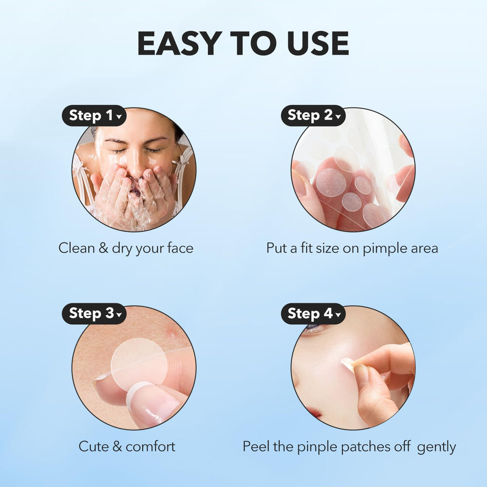 QUSTERE pimple patches applied on skin during rest for discreet healing.