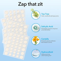 QUSTERE pimple patches with tea tree and salicylic acid for soothing action.