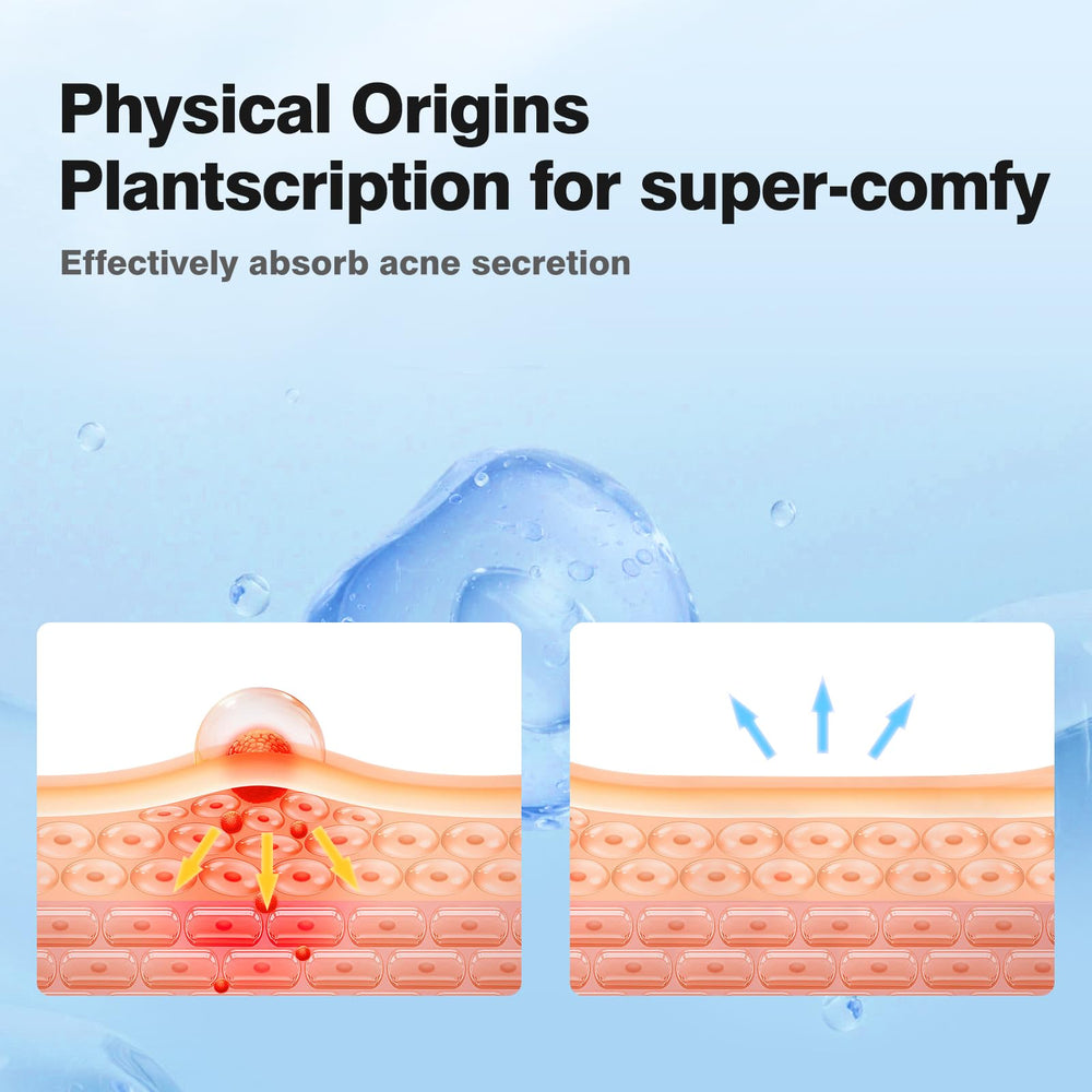 QUSTERE 8mm XS patch demonstrates precise sizing for small blemishes