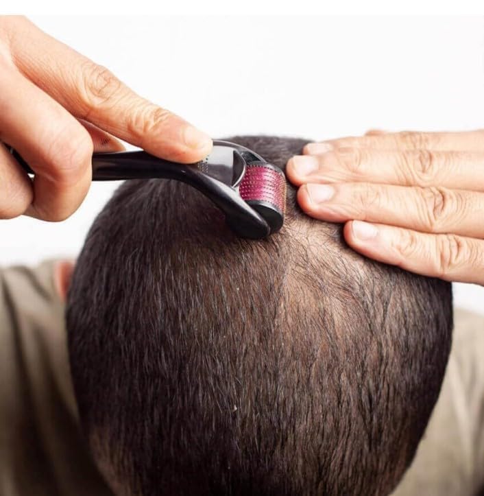 RadBizz Derma Roller in use demonstration on skin