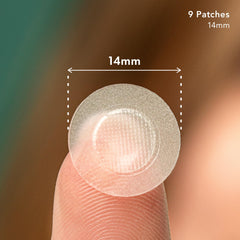 Rael hydrocolloid acne patch close-up protects irritated skin.
