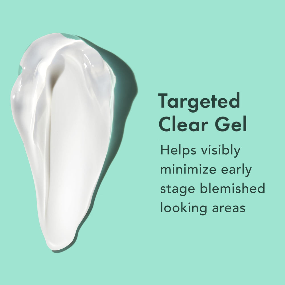 Rael Miracle Clear Spot Gel featuring succinic acid targets early blemishes