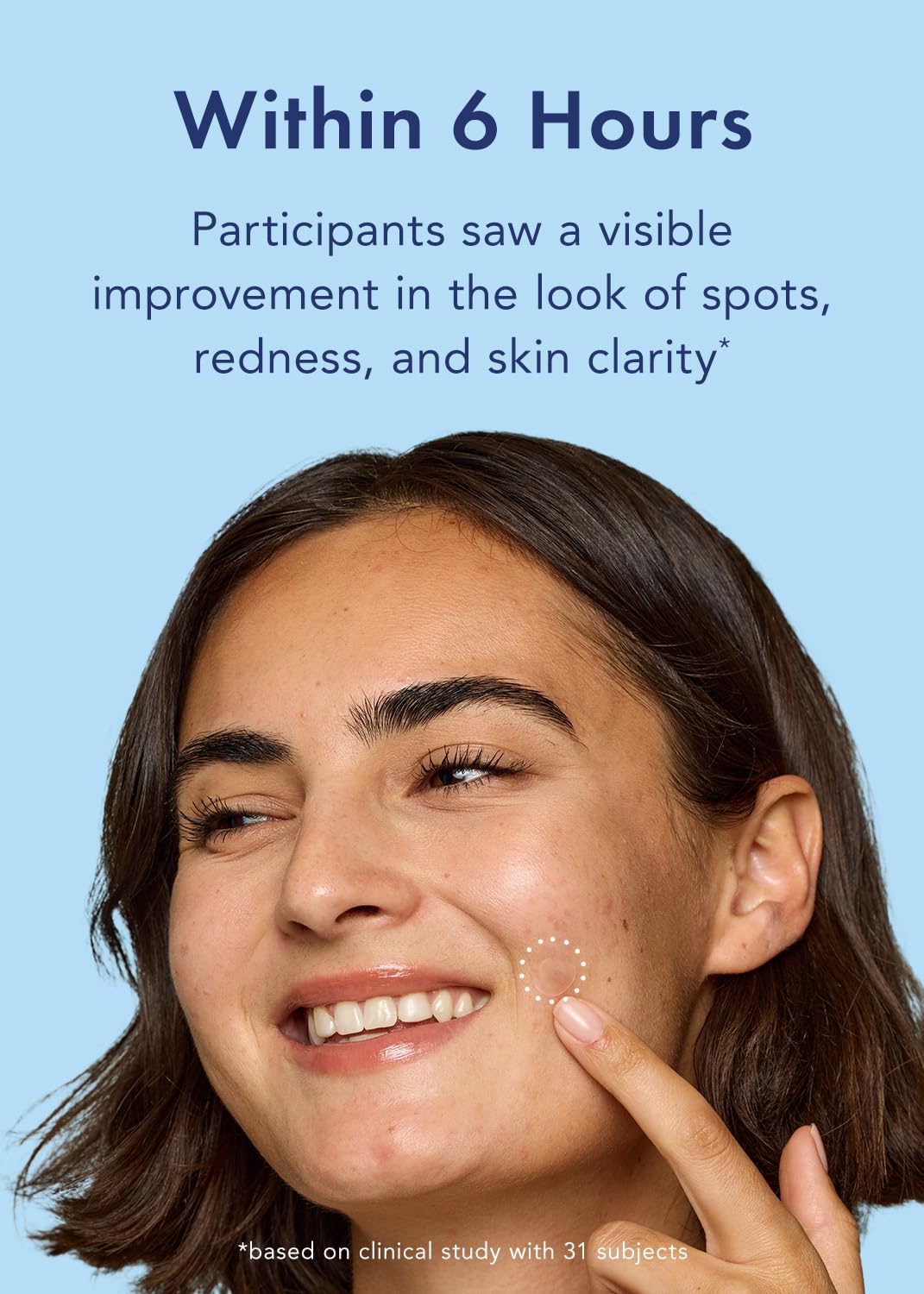Rael pimple patches on blemish skin absorb fluids overnight for impurity management.