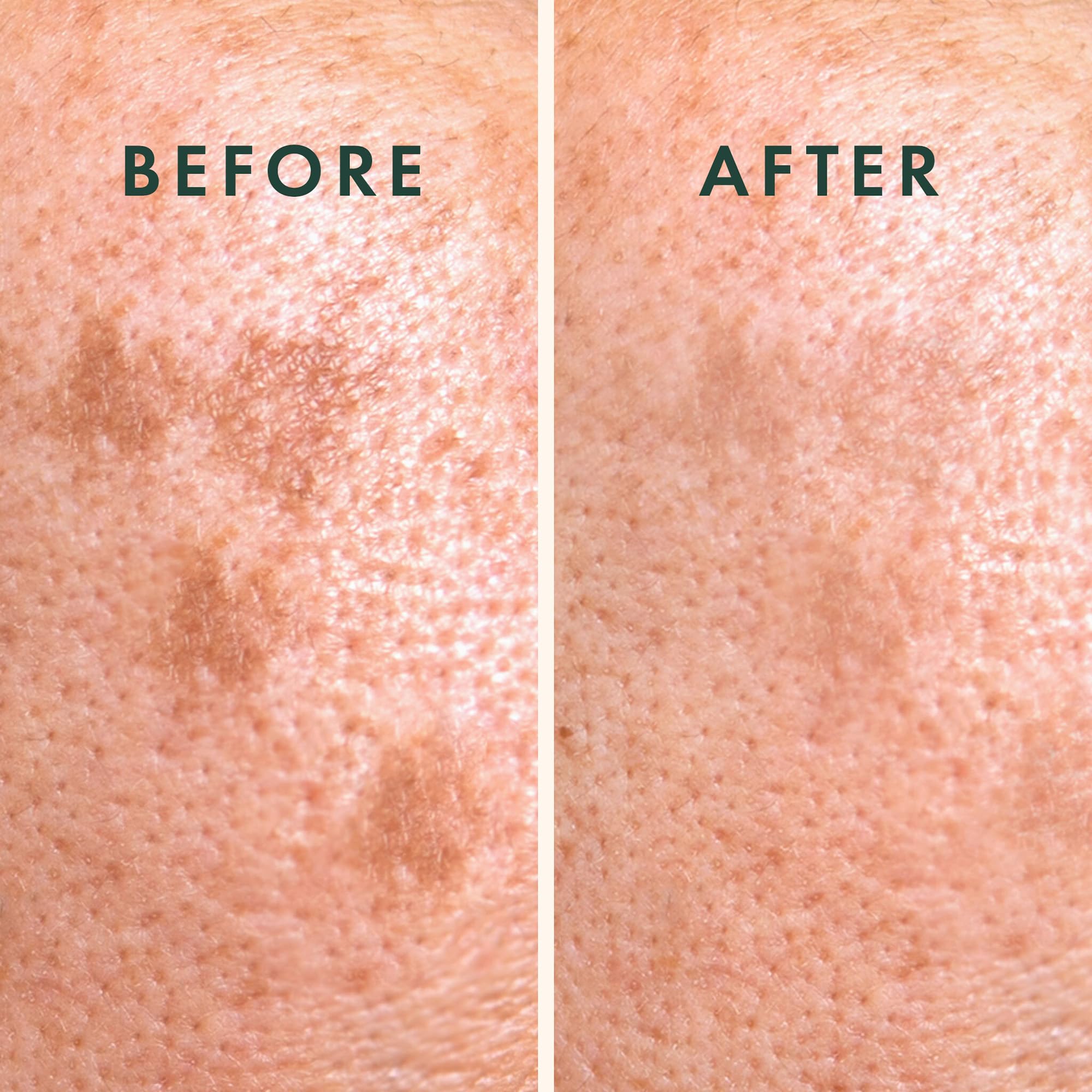 Rael patch ingredients close-up shows Vitamin C and Niacinamide for even tone