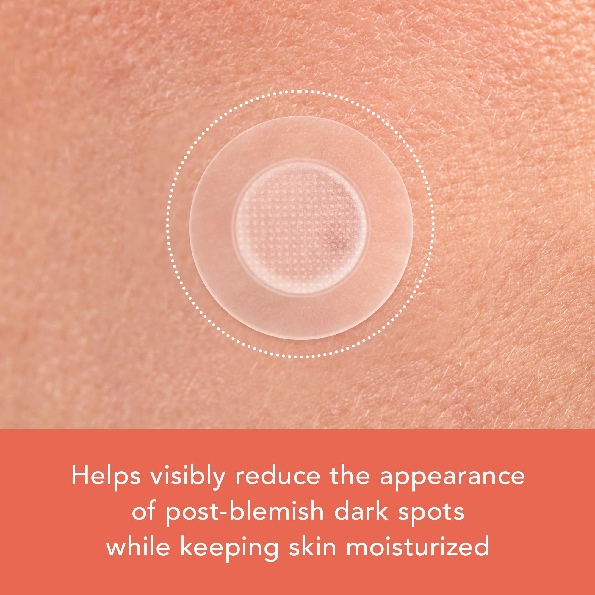 Rael patch application close-up highlights convenient one-step blemish care