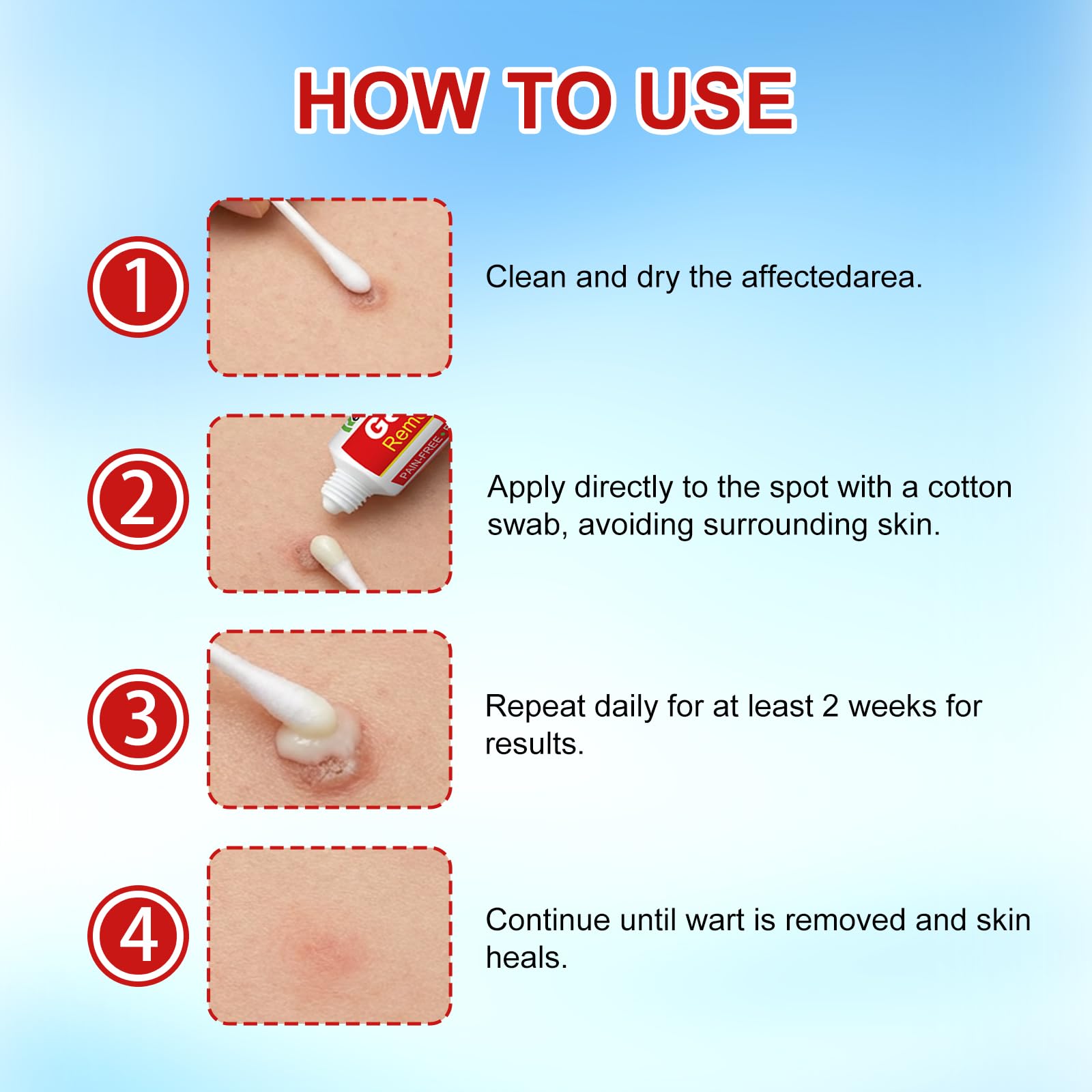 Hand applying Reaua gel on multiple areas demonstrates multi-area use