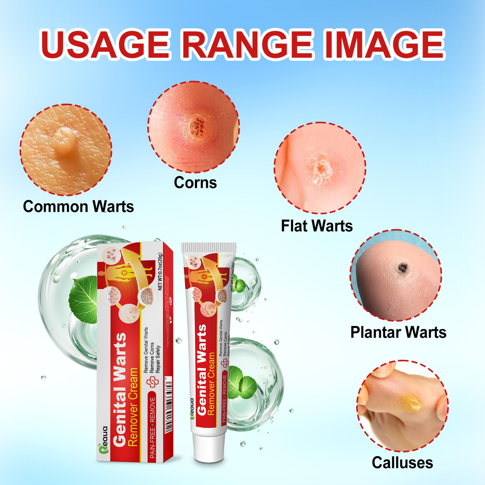 Reaua Wart Remover Gel precision applicator enables targeted spot treatment