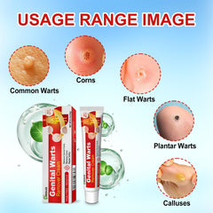 Reaua Wart Remover Gel precision applicator enables targeted spot treatment