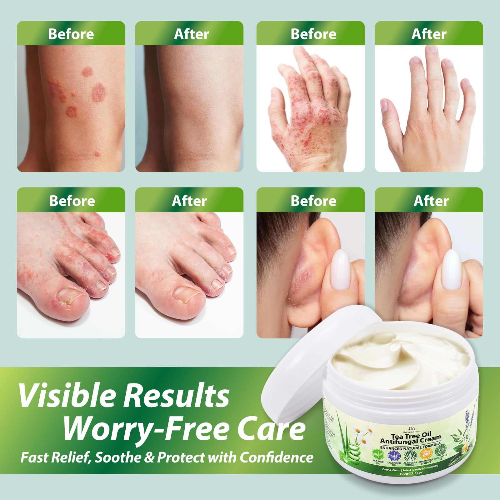 Recuren Plus packaging box; clear product details for easy selection.