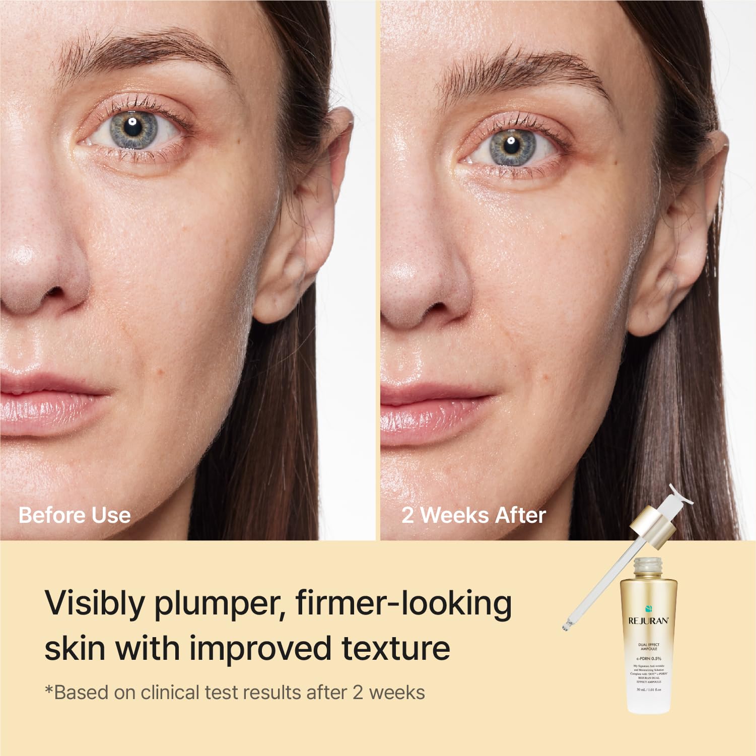 REJURAN Ampoule packaging demonstrates easy, daily use.