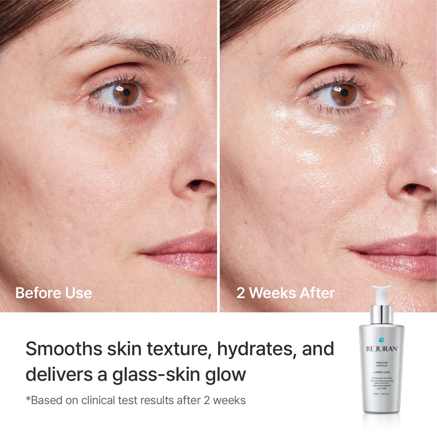 REJURAN Turnover Ampoule provides lasting hydration for soft skin.