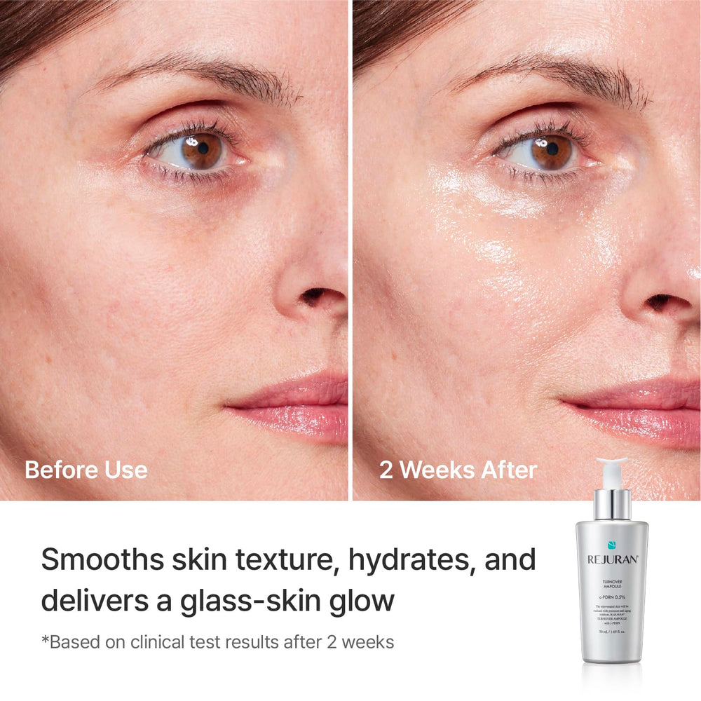 REJURAN Turnover Ampoule provides lasting hydration for soft skin.