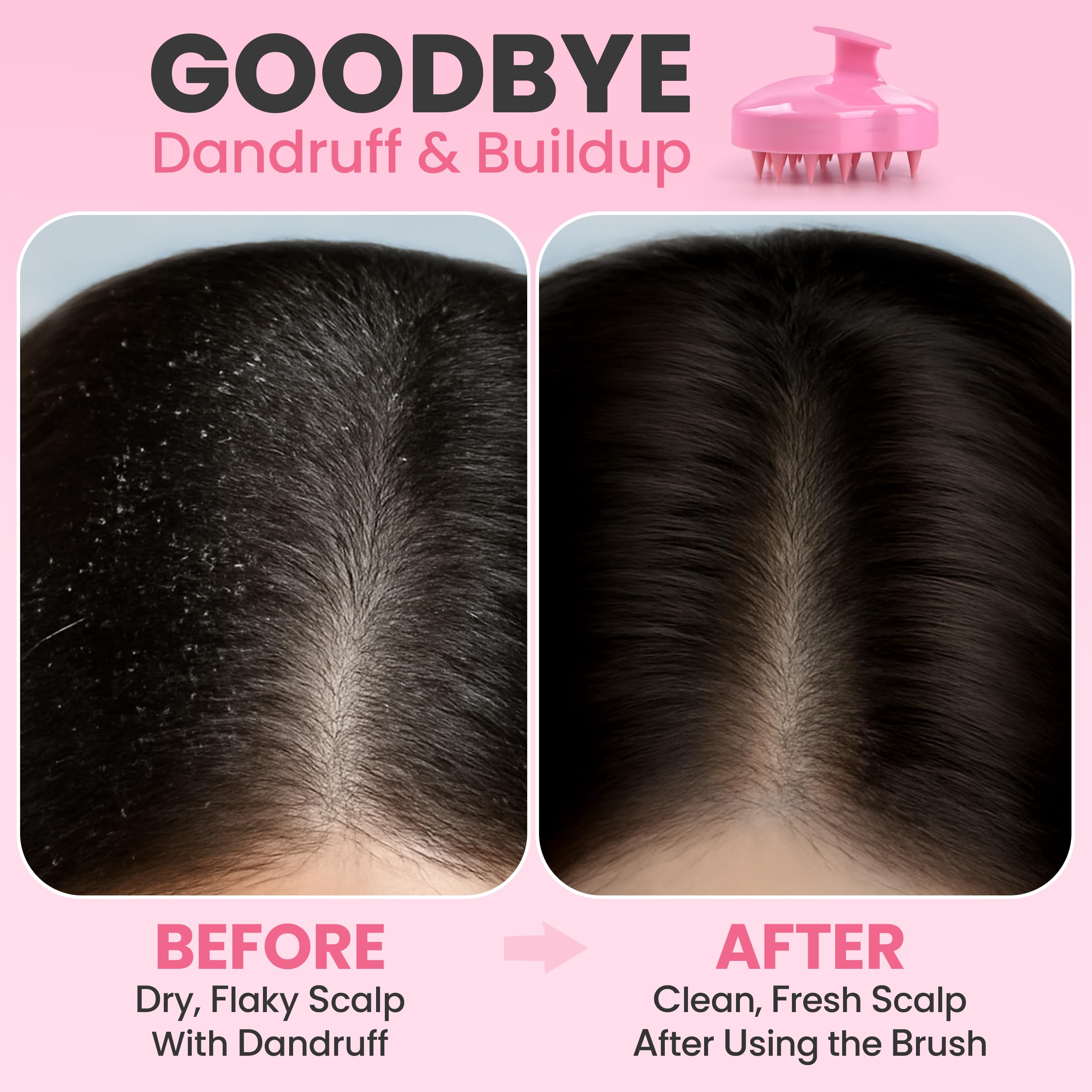 RELAXXO ergonomic grip handle for easy, comfortable scalp massages.