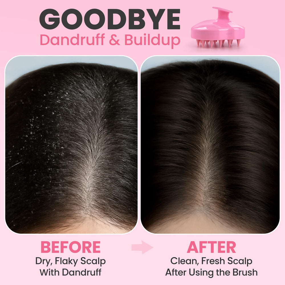 RELAXXO ergonomic grip handle for easy, comfortable scalp massages.