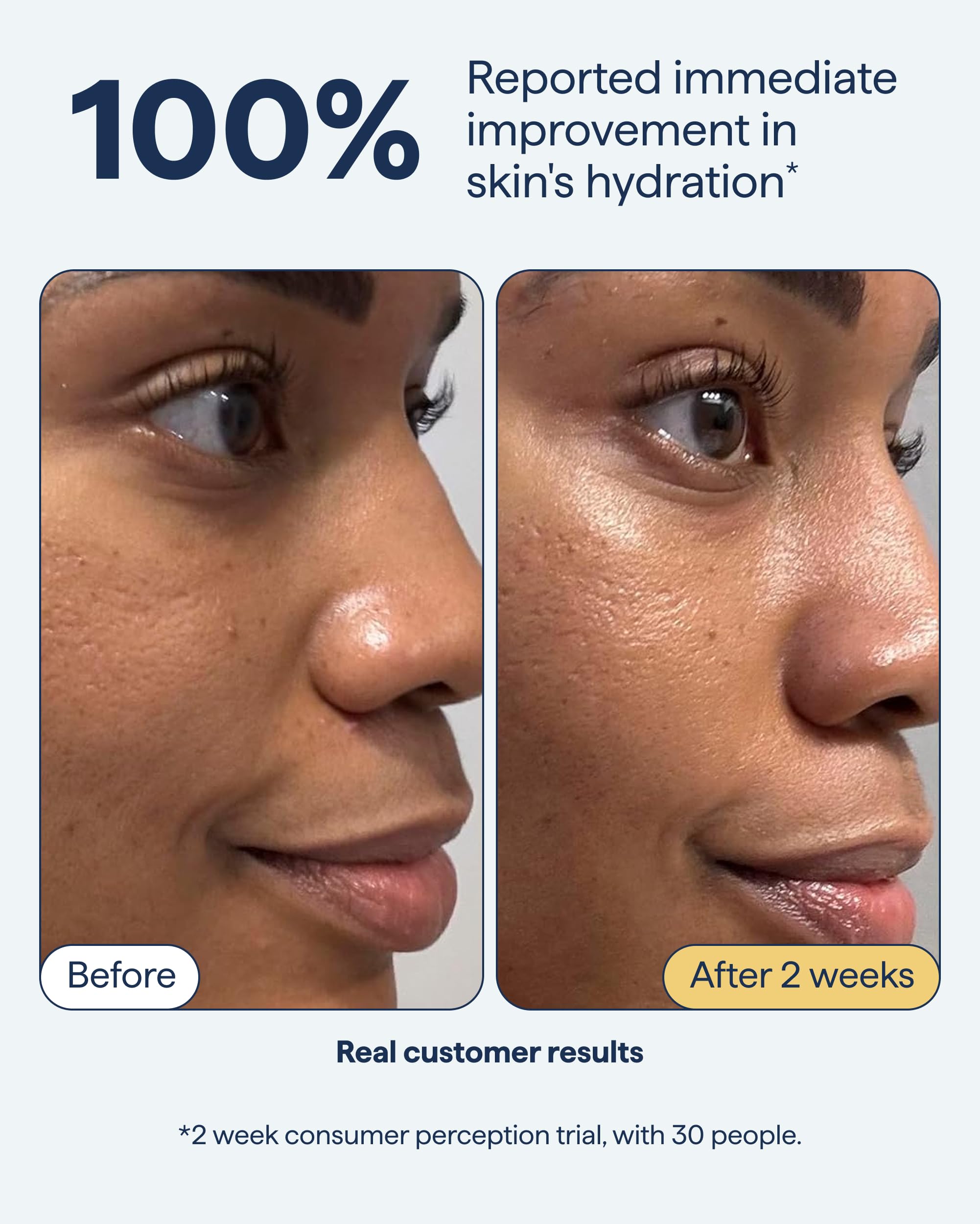 Remedy Science ingredients layout: glycerin, squalane, peptides, niacinamide.