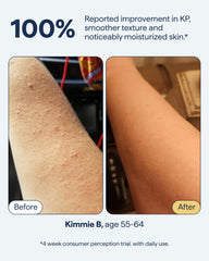 Remedy Science KP Exfoliating Body Moisturizer applied on arm indicates gentle use.