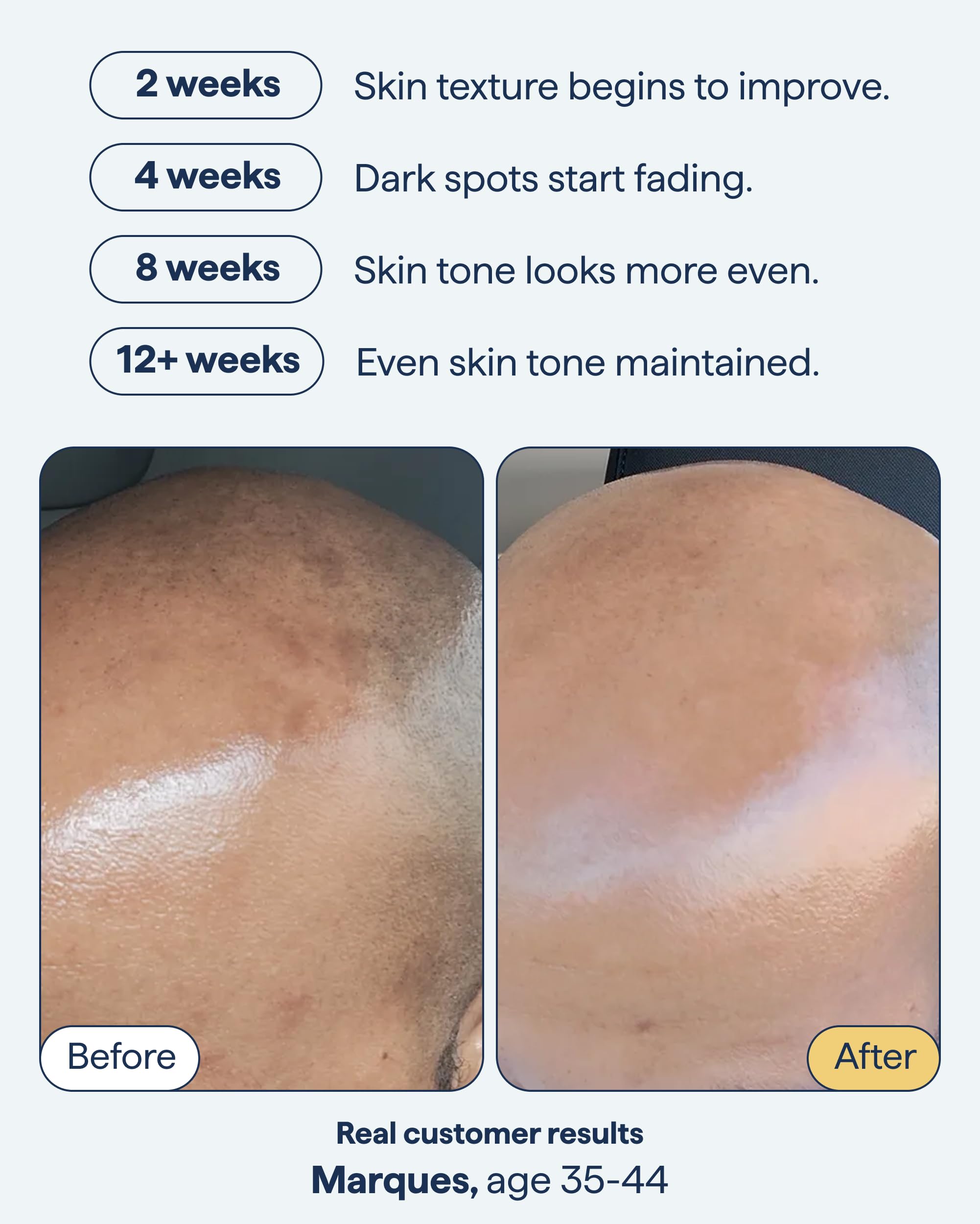 Remedy Science encapsulated retinol 0-1 percent shows gentle, controlled delivery.