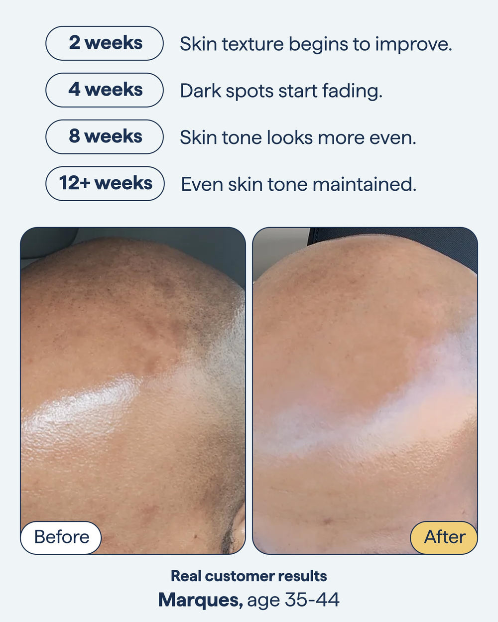 Remedy Science encapsulated retinol 0-1 percent shows gentle, controlled delivery.
