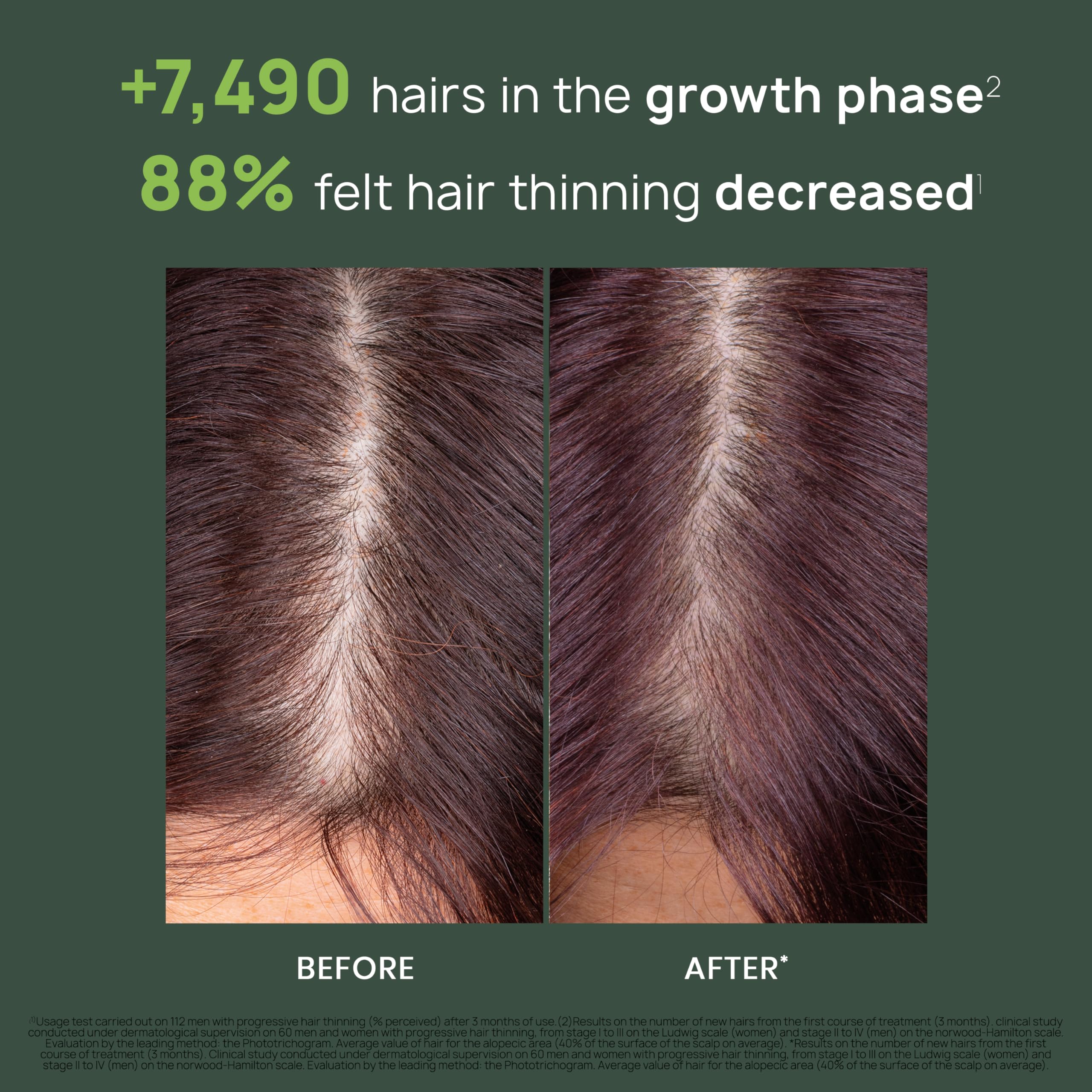 Damp scalp massage with René Furterer Triphasic serum promotes energizing care.