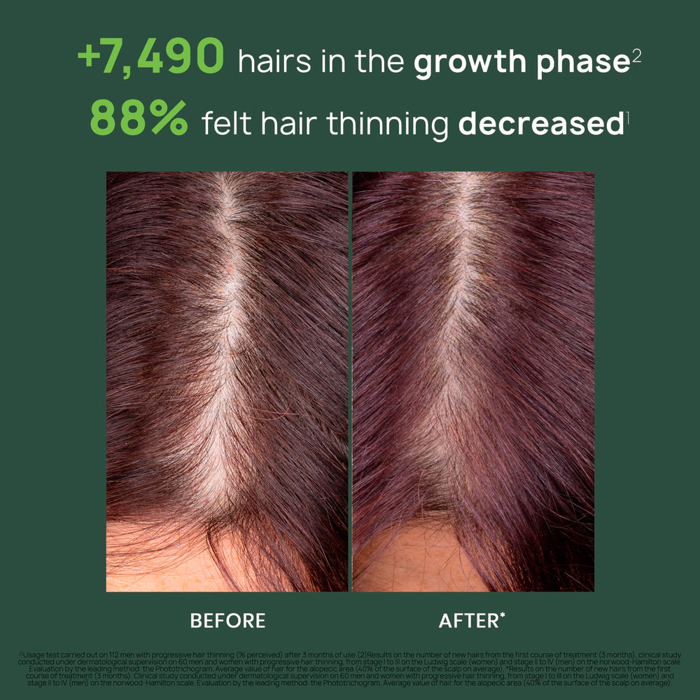 Damp scalp massage with René Furterer Triphasic serum promotes energizing care.