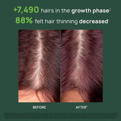 Damp scalp massage with René Furterer Triphasic serum promotes energizing care.