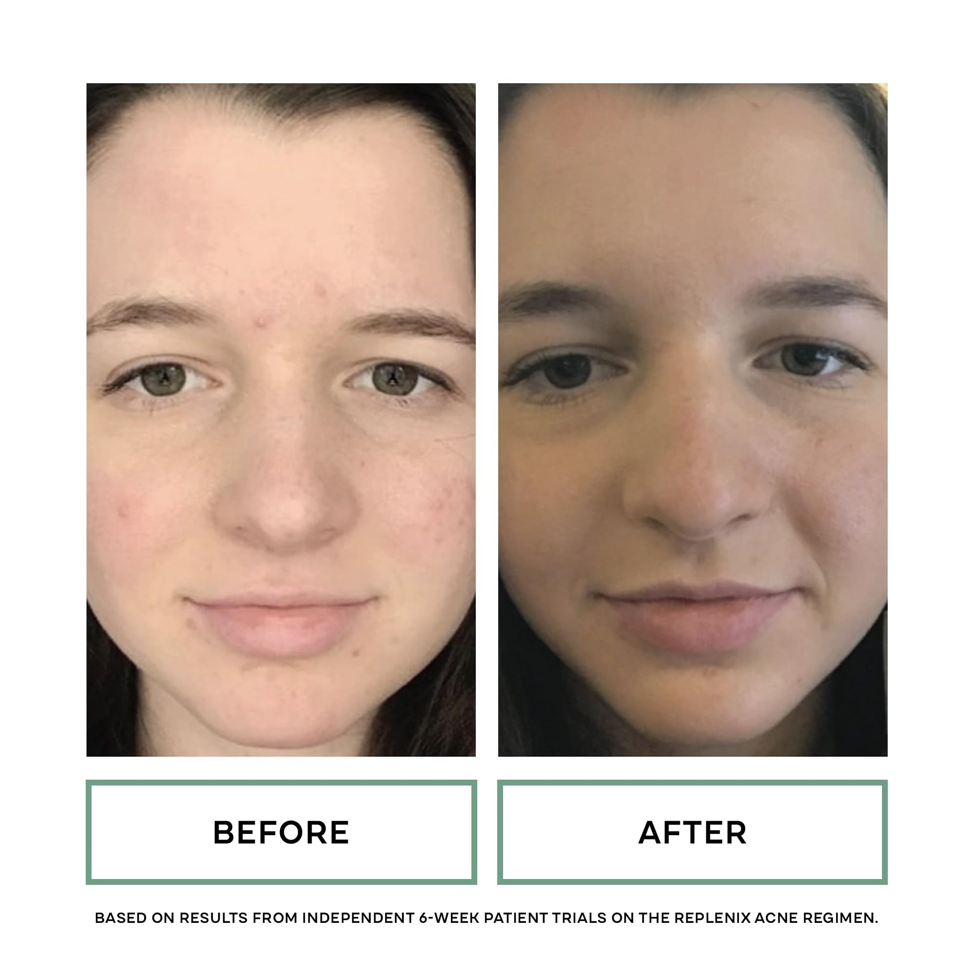 Green tea-infused formula in Replenix Gly-Sal supports calming skin