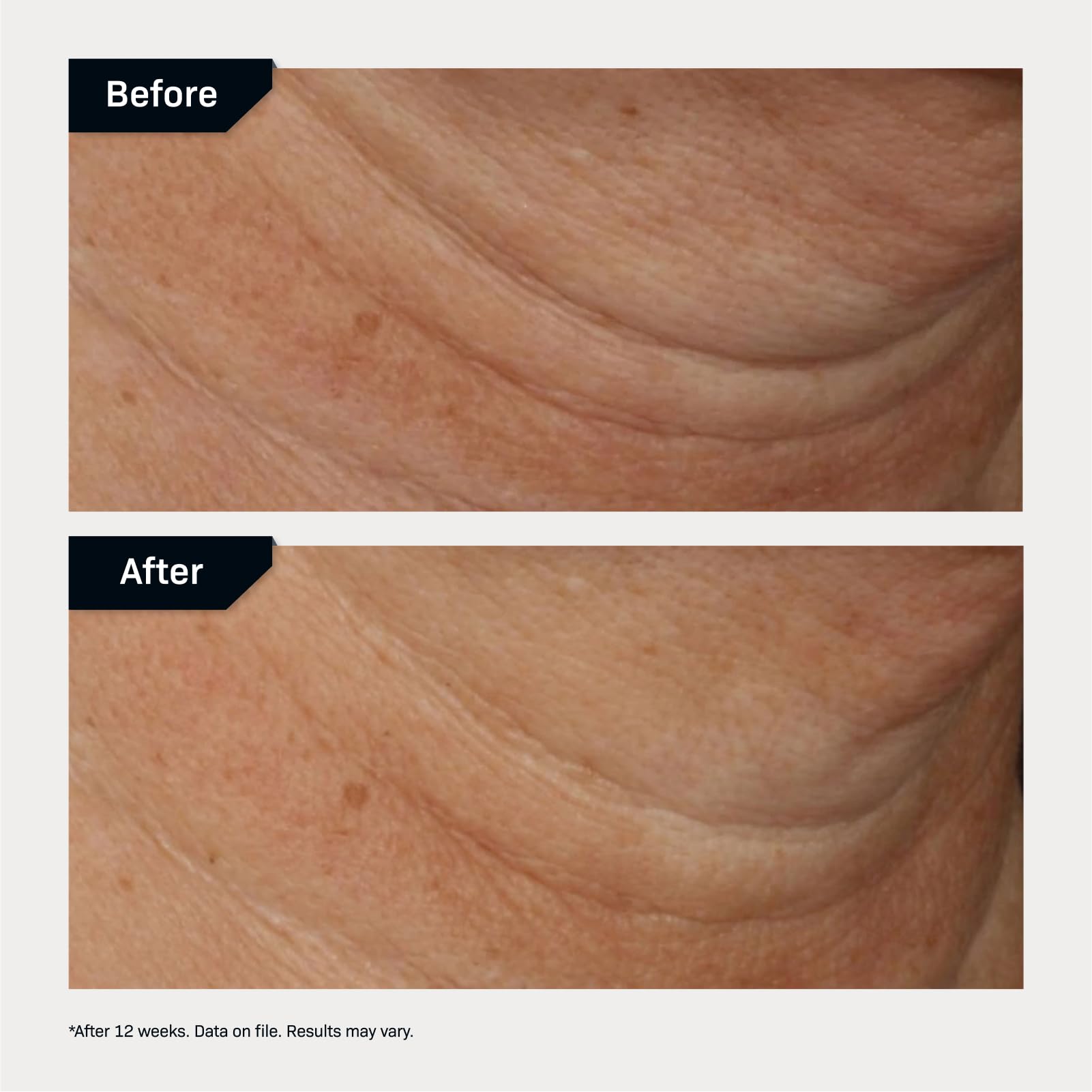 Revision Skincare Nectifirm Advanced neck-cream closeup on crepey skin texture.
