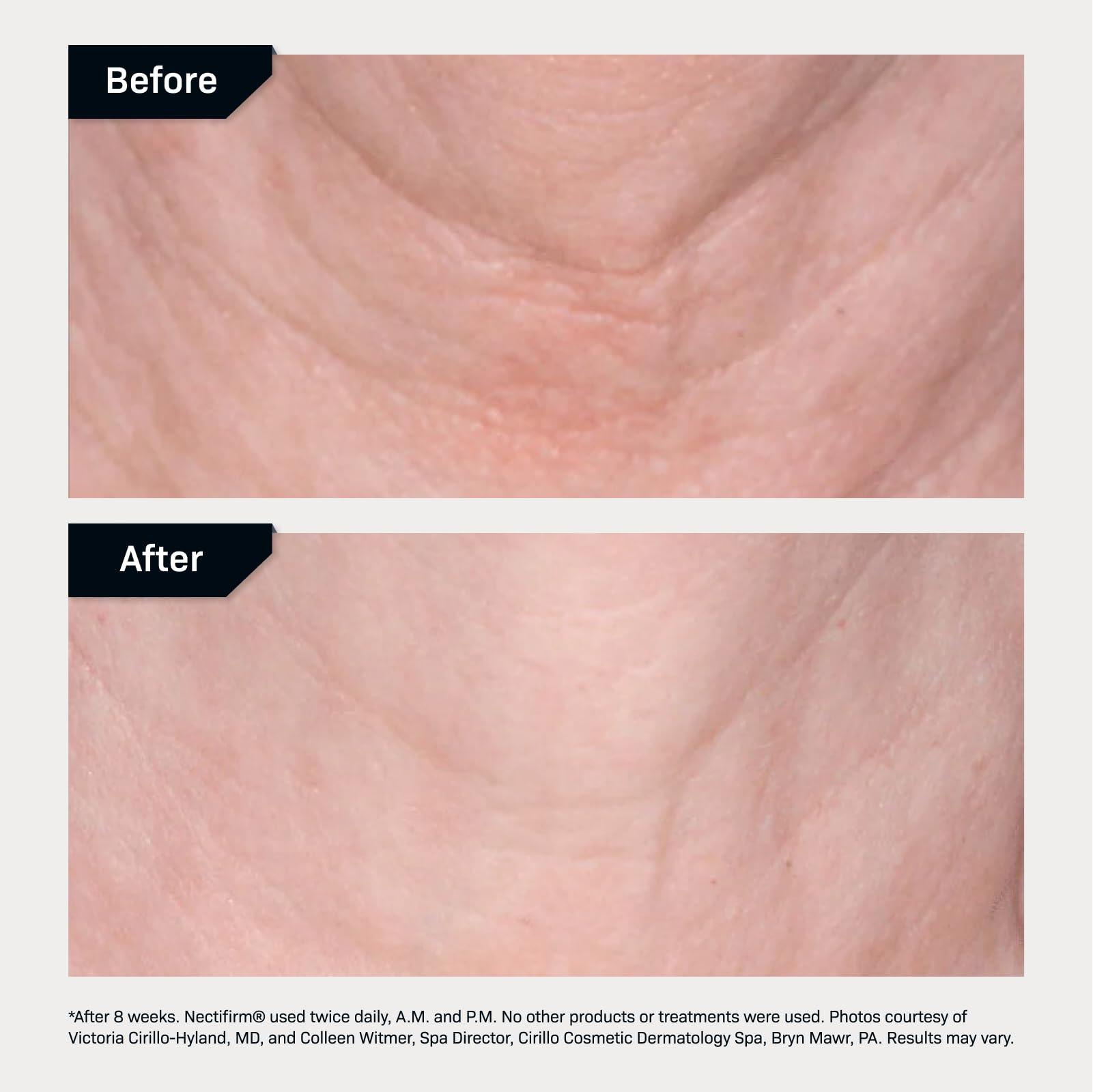Revision Skincare Nectifirm Advanced packaging shot emphasizes premium formula and clean design