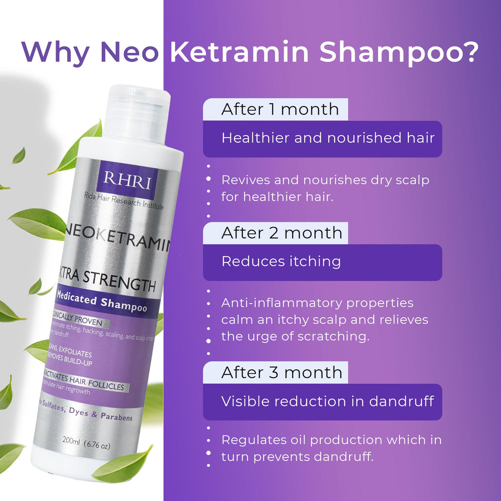 Rida Hair Antifungal Shampoo lather on hand — rich foaming action for thorough scalp cleansing.