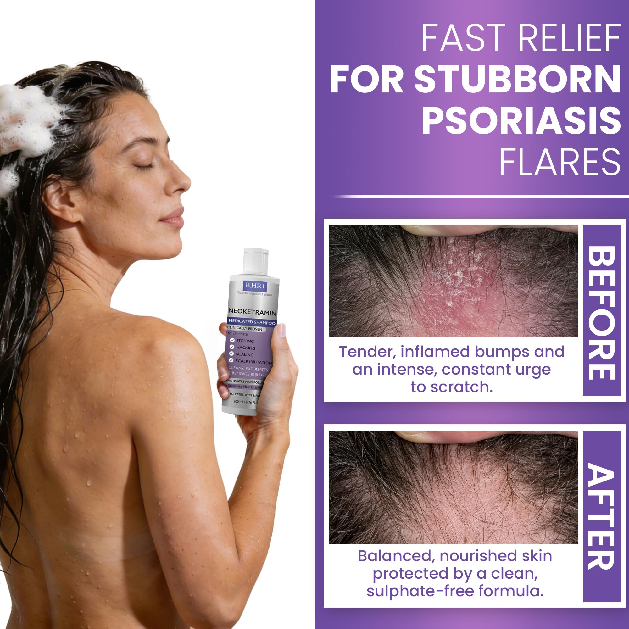 Rida Hair Antifungal Shampoo pump-dispense — easy controlled application for daily use.
