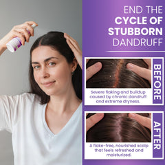 Rida Neoketramin bottle on vanity showcases clean, lightweight scalp care.