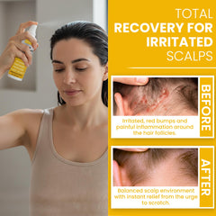 Rida Psoriasis Scalp Spray droplets show even coverage across the scalp.