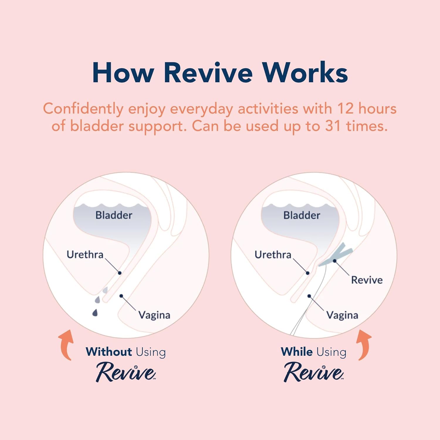 RINOVUM Revive easy insertion highlights user-friendly design for quick use.