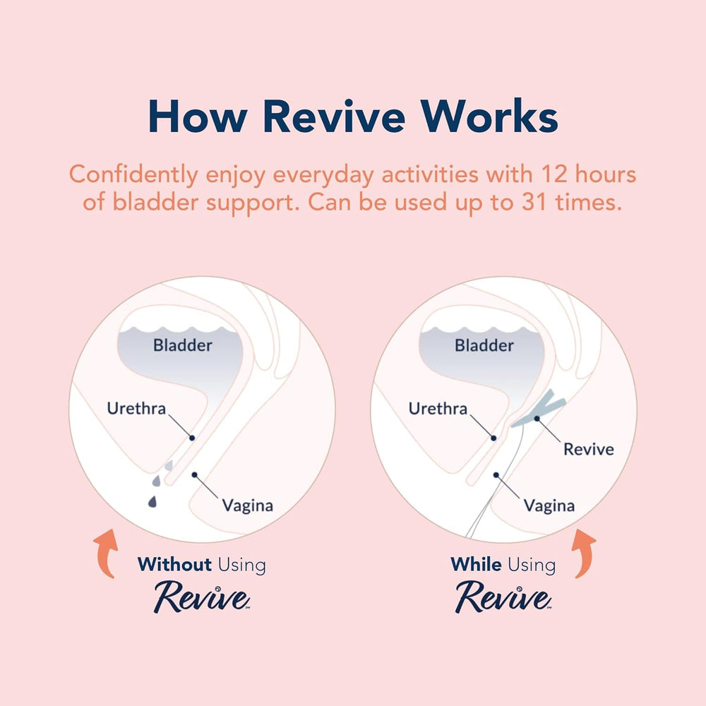 RINOVUM Revive easy insertion highlights user-friendly design for quick use.