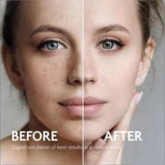 Rivocoda Hydraquinon0l application on skin demonstrates smooth spreading.