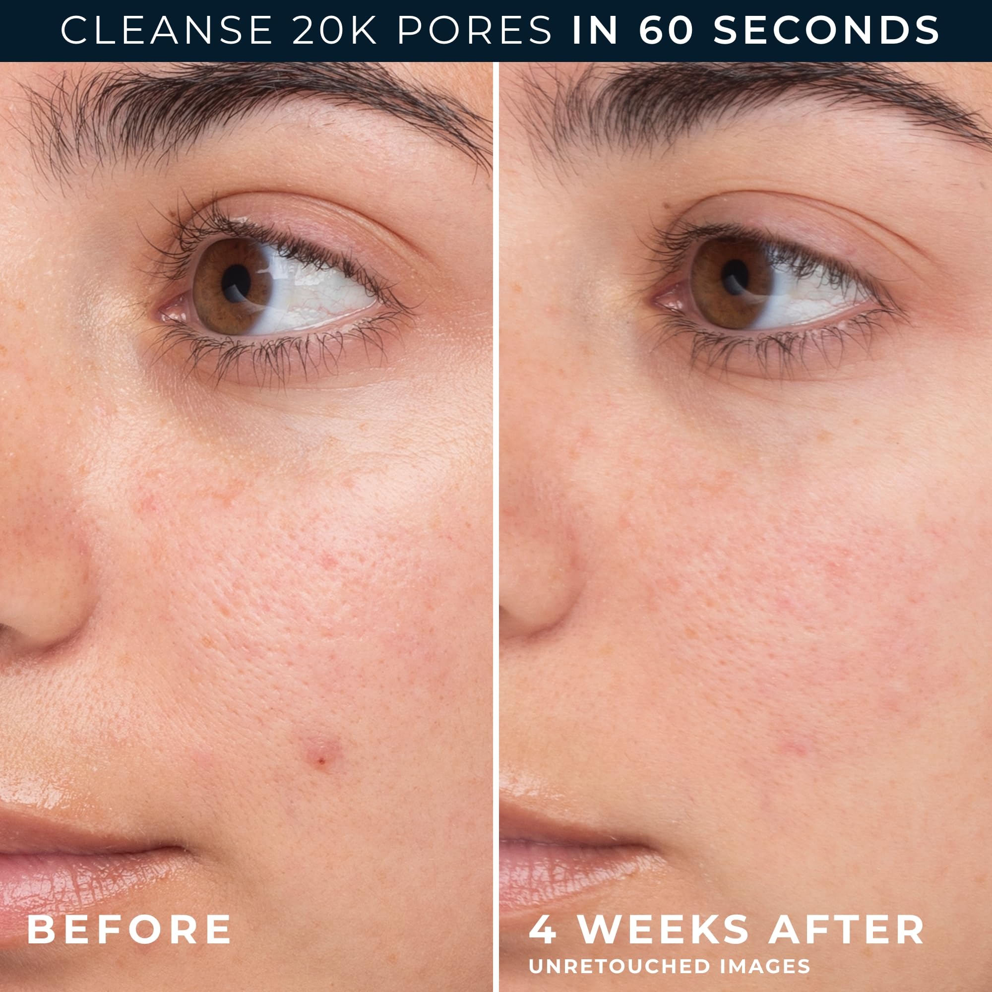 RoC Barrier Renew ingredients with ceramides, green tea and glycerin for balanced skin.